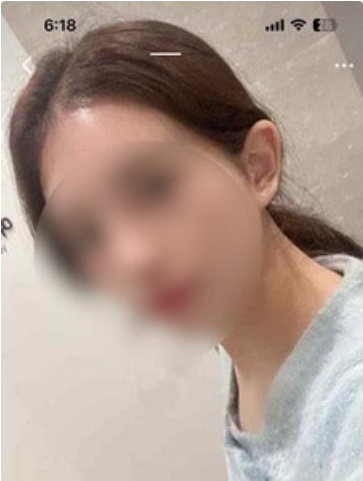 글램 티어 6.64→9.71 폭등. 불안했던 단 한번의 선택이 인생을 뒤바꾼 단 한번의 선택이었습니다 후기 이미지 13