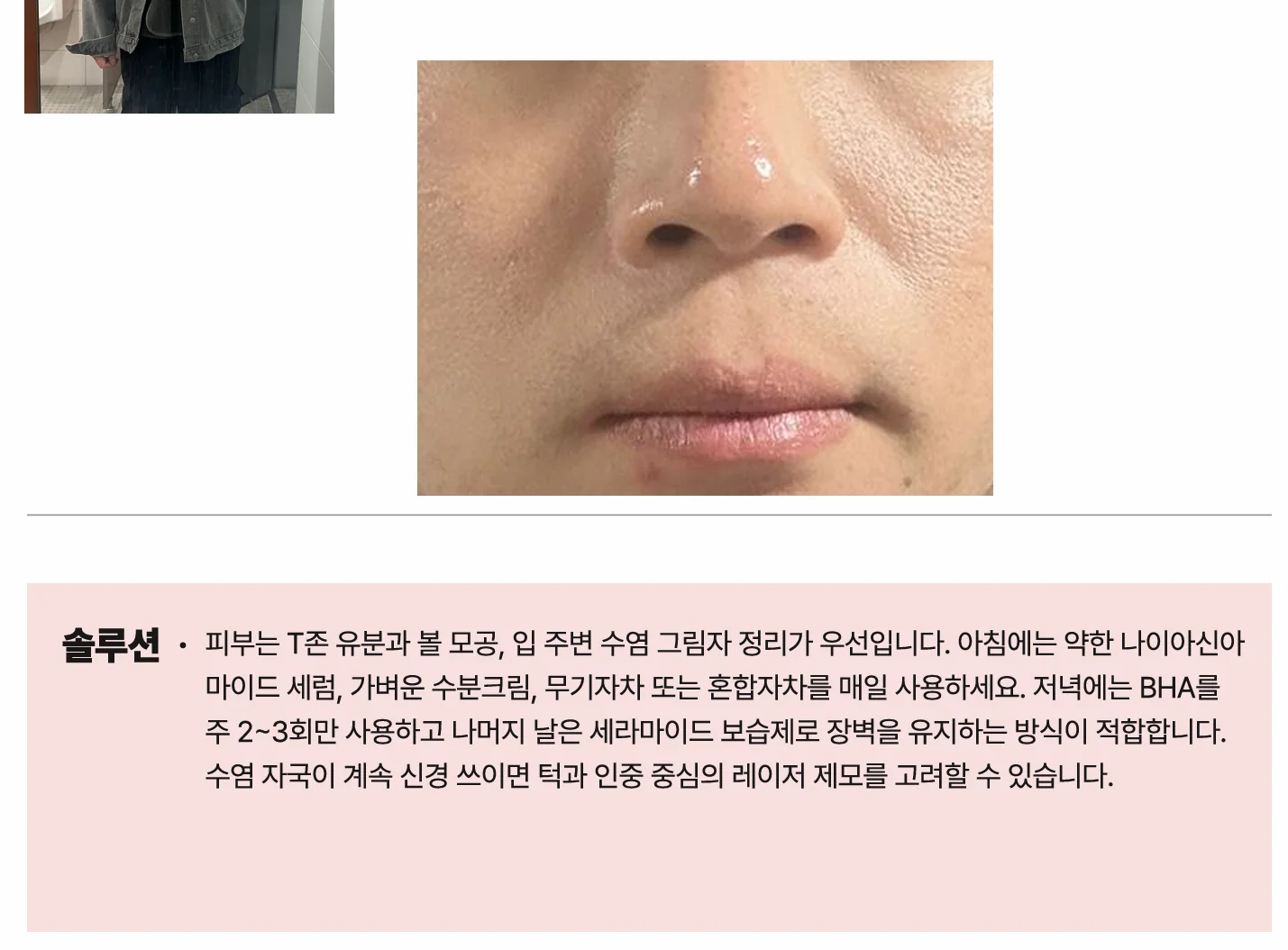 후기 이미지